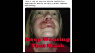 THIS IS WHAT YOU GET - KEEP WEARING THAT MASK