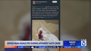 Jewish man attacked in apparent hate crime in Beverly Hills speaks out