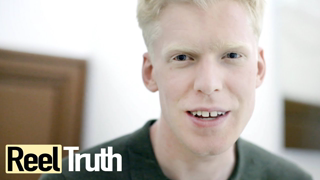 Born Too White: What It's Like To Have Albinism in Tanzania | Full Documentary | Reel Truth