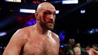 Tyson Fury admits Zionist Jews CONTROL government and media