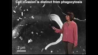 PFIZER Contains TRYPANOSOMA CRUZI PARASITE, American Scientists Confirm Graphene Oxide In Vaccines