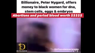 Billionaire tries to buy black woman stem cellsðŸ©¸â€¦. Listen to what he says about how much it's worth!!!