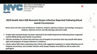 NYC 2019 HEALTH ALERT#28 - (DOS) Direct Orogenital Suction