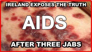 IRELAND AND OTHER COUNTRIES EXPOSE THE TRUTH THAT AFTER THREE JABS, YOU WILL TEST POSITIVE FOR AIDS