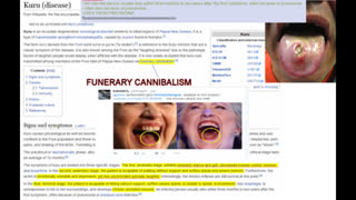 Hillary Clinton Has KURU (disease) - Stems From Funerary Cannibalism