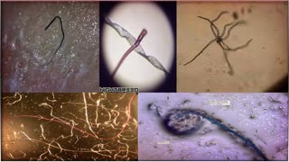 Morgellons GMO Foods Nano Technology - Alex Jones 4-19-11