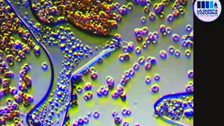 BLOOD ANALYSIS OF ''VAXXINATED'' PEOPLE (HAXON AQUILES II) + ULTRAVIOLET PULSE STIMULATION !