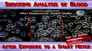 Shocking Analysis of Blood after Exposure to a Smart Meter