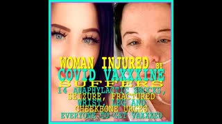 WOMAN INJURED BY COVID VACCINE HAS SEIZURE, 14 ANAPHYLACTIC SHOCKS & COMA