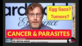 PARASITE EGG SACS Being Diagnosed as CANCER