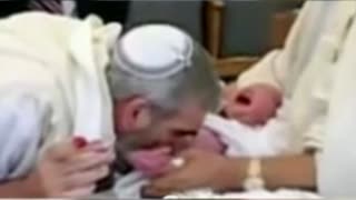 Local Rabbi accused of infecting babies with herpes - Circumcision