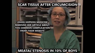 Ming-Hsien Wang on Meatoplasty